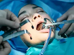 Oral Surgery